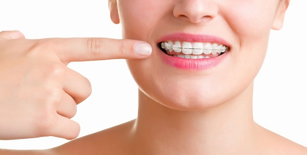 Hiện nay, niềng răng đươc cải tiến thành nhiều phương pháp đa dạng đáp ứng mọi nhu cầu của tất cả khách hàng