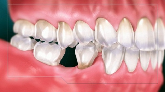 Răng hàm đảm nhiệm vai trò quan trọng trong ăn nhai, có chức năng chính là cắn, xé và nghiền thức ăn