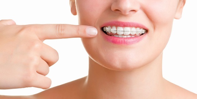 Hiện nay, niềng răng được cải tiến thành nhiều hình thức đa dạng đáp ứng sự lựa chọn của các khách hàng
