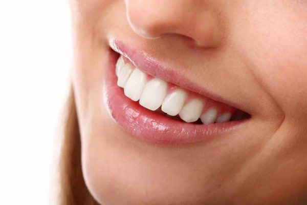 Thời gian niềng răng hô có thể kéo dài lên tới 24 tháng tùy thuộc vào tình trạng răng miệng và phương pháp niềng