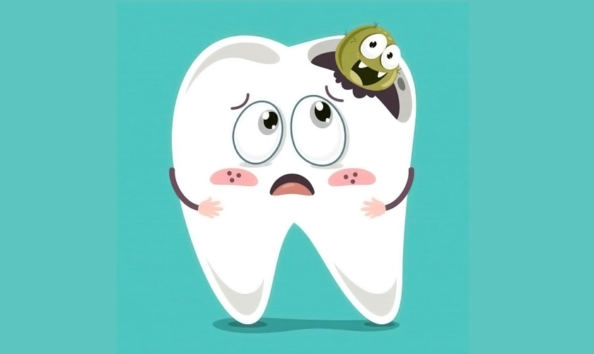 Sâu răng xảy ra khi cấu trúc răng bị vi khuẩn tấn công, tạo thành những lỗ li ti trên bề mặt răng