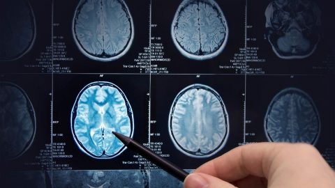 Bệnh nhân được chỉ định chụp CT sọ não khi nào?