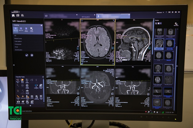 Chụp MRI não giúp phát hiện các bệnh lý tiềm ẩn