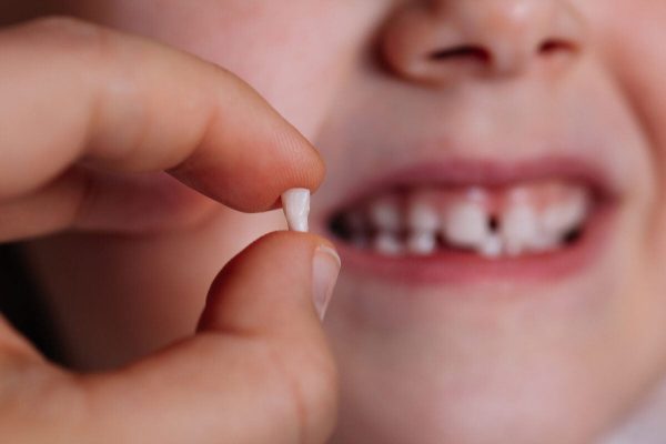 Trẻ bắt đầu thay răng sữa để nhường chỗ cho những chiếc răng vĩnh viễn mọc lên khi 5-6 tuổi