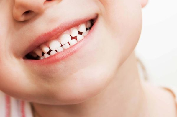 Có bao nhiêu răng sữa phải thay ở trẻ: Mỗi đứa trẻ sẽ thay tổng cộng 20 chiếc răng sữa trên cung hàm