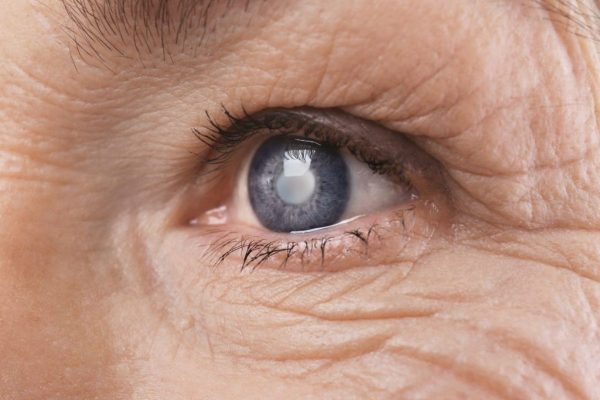 Chấn thương, bệnh lý, tật khúc xạ… là các nguyên nhân gây giảm thị lực ở mọi người hiện nay