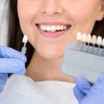 Chăm sóc răng sau khi dán veneer đúng cách