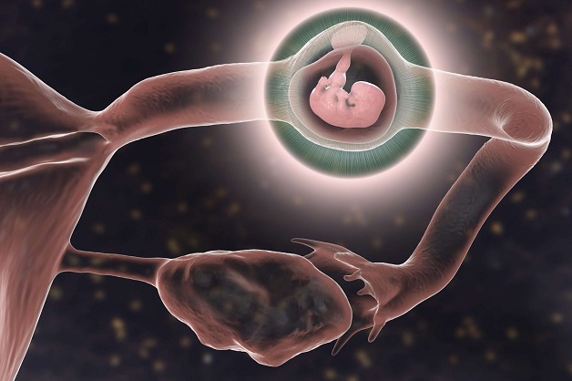 Chửa ngoài dạ con là hiện tượng thai nghén bất thường, phôi thai sau khi thụ tinh không thể di chuyển vào buồng tử cung làm tổ mà bị lưu lại ở buồng trứng, vòi trứng, vòi tử cung, cổ tử cung,...