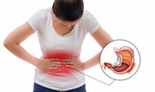Nguyên nhân viêm loét dạ dày và một số dấu hiệu nhận biết
