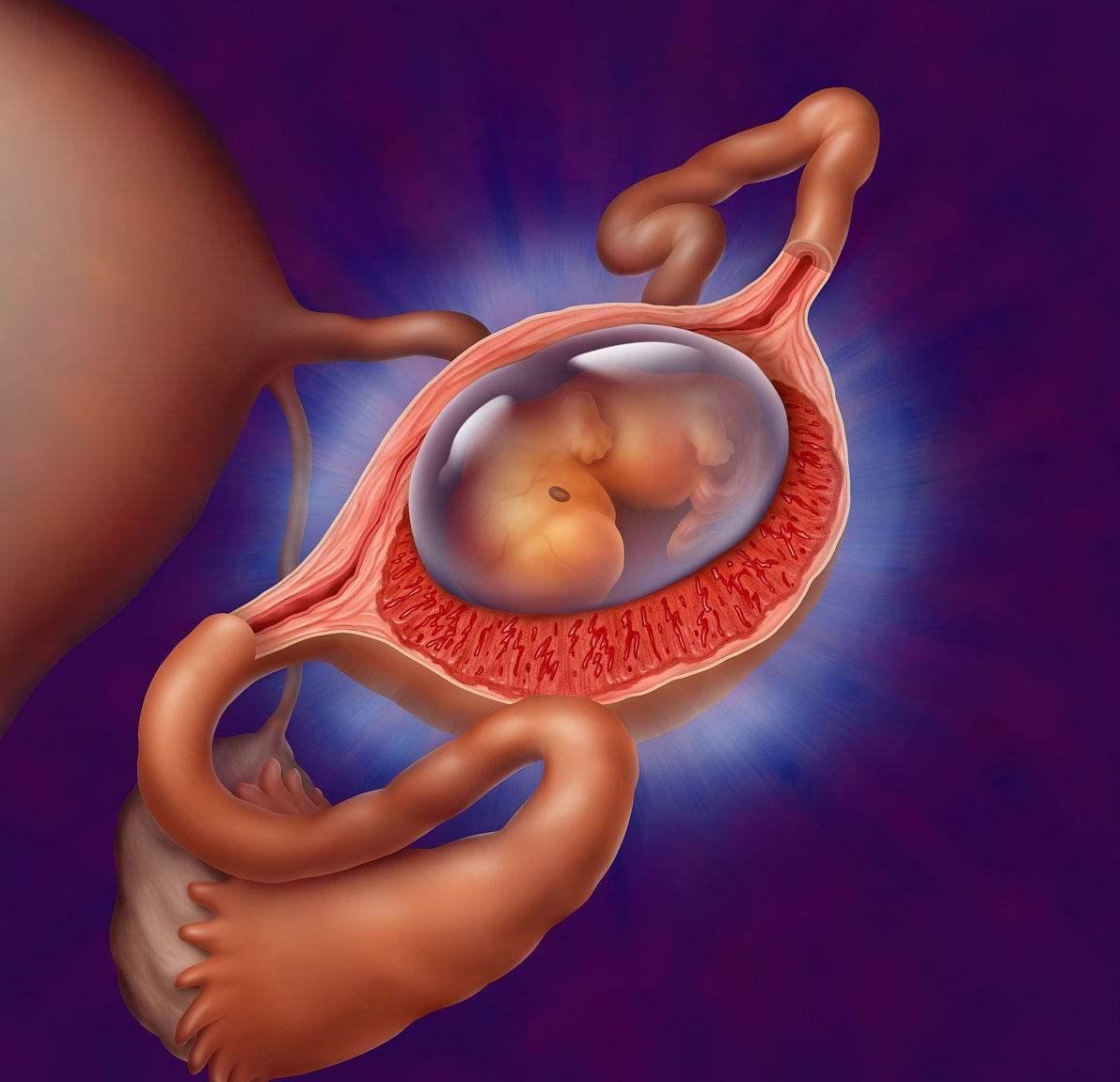 Nguyên nhân dẫn đến thai ngoài tử cung là do ống dẫn trứng bị hẹp, có dị tật ở ống dẫn trứng, đã từng phẫu thuật vòi trứng,...