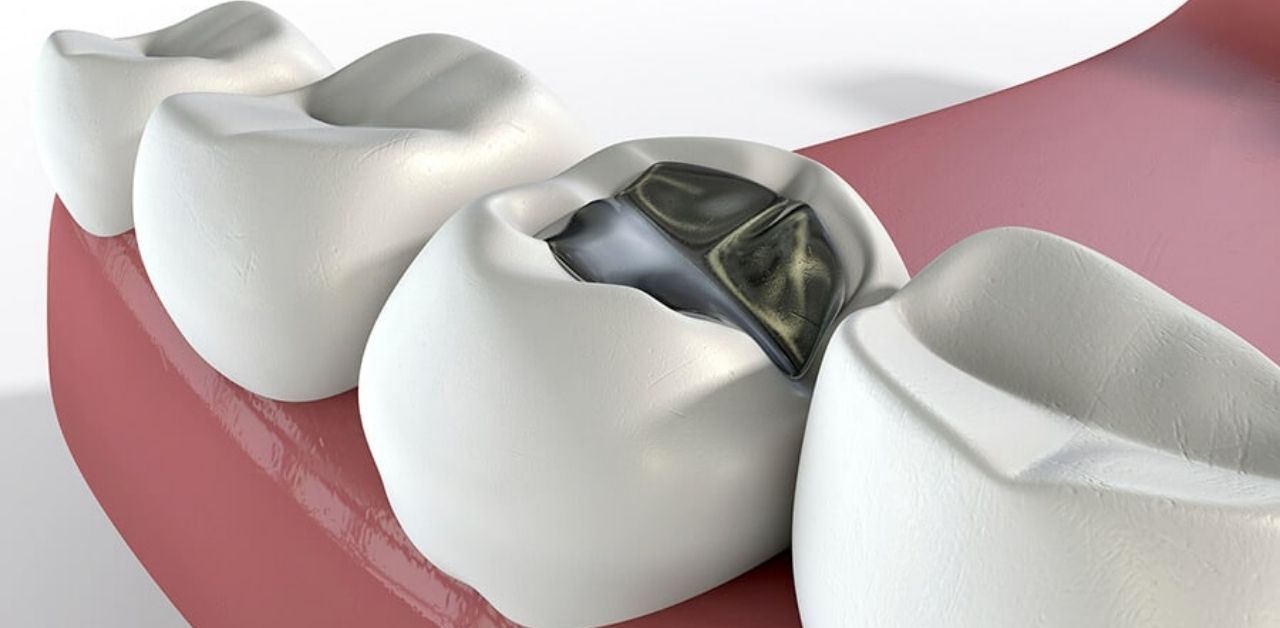 Vì sao răng số 6 có vai trò quan trọng trong chức năng nhai?
