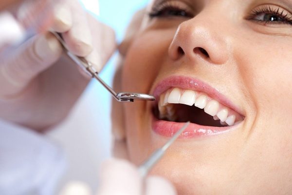 Lý do tại sao phải chăm sóc răng miệng? - Răng miệng được chăm sóc kỹ lưỡng sẽ ngăn ngừa nguy cơ mắc bệnh lý răng miệng nguy hiểm
