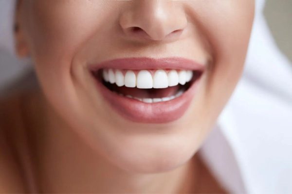 Dán sứ veneer là phương pháp phục hình răng miệng tối ưu, giúp mọi người có thể sở hữu nụ cười tự tin rạng ngời