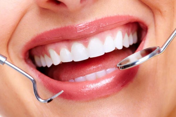 Lấy cao răng có lâu không còn phụ thuộc vào mức độ cao răng và tay nghề thực hiện của bác sĩ