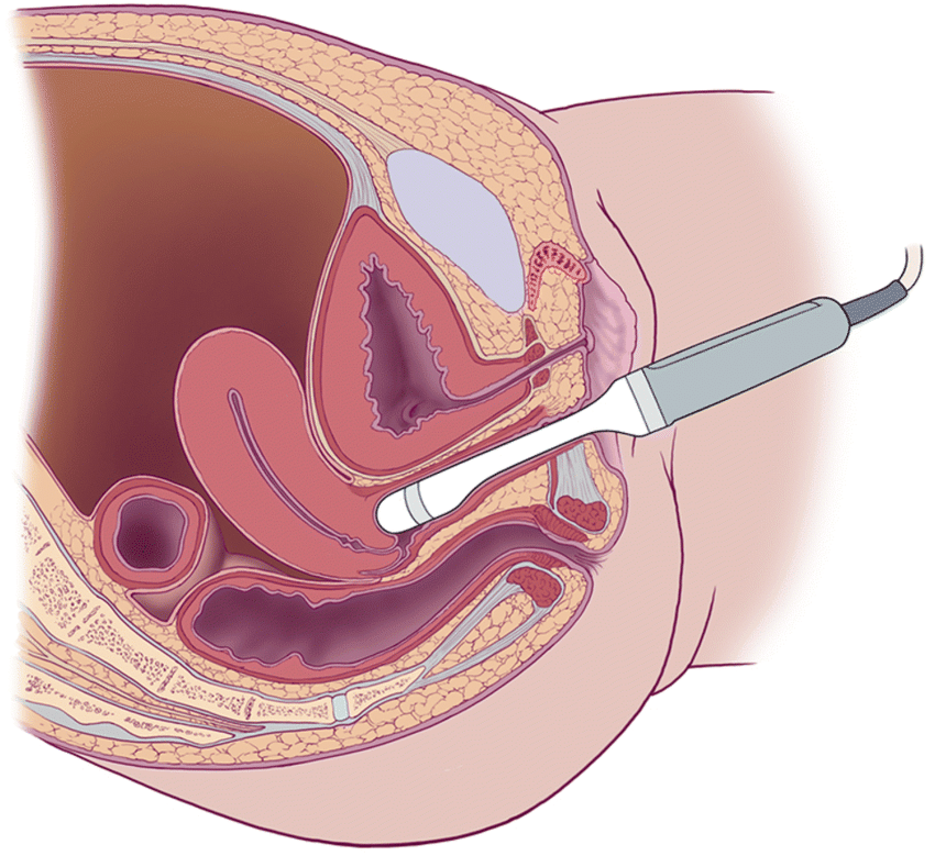 Thông thường, siêu âm 9 tuần nên thực hiện siêu âm đầu dò để quan sát rõ hơn tình trạng thai nhi