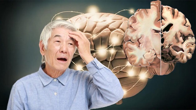 Bệnh Alzheimer gây nhiều nguy hiểm 