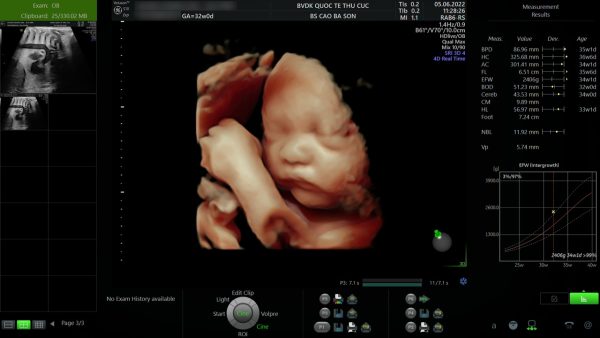Siêu âm thai 4D: Hãy xem ảnh liên quan đến dịch vụ kỹ thuật siêu âm thai 4D để chứng kiến sự phát triển của thai nhi một cách chân thật và sống động. Chúng tôi sẽ giúp bạn cảm nhận tình yêu và sự kì diệu của cuộc sống được tạo ra từ những chuyển động nhỏ bé của con trong bụng mẹ.