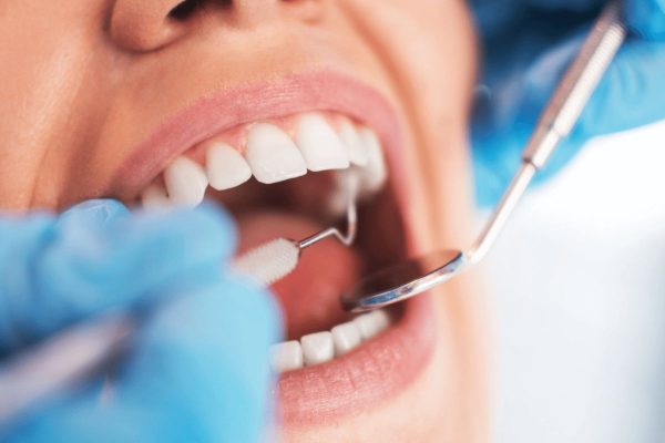 Răng lấy tủy thường không bền lâu so với răng khỏe mạnh ban đầu