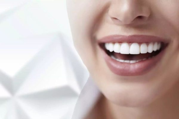 Tuổi thọ của răng sứ thường sẽ kéo dài trên 15 năm tùy vào tình trạng sức khỏe răng miệng của từng người