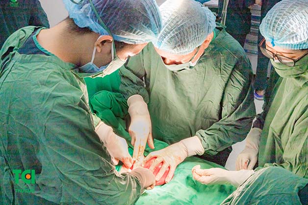 Các bác sĩ thực hiện phẫu thuật u xơ tử cung tại Thu Cúc TCI đều là những bác sĩ chuyên khoa hàng đầu, nhiều kinh nghiệm xử lý tốt các ca phẫu thuật