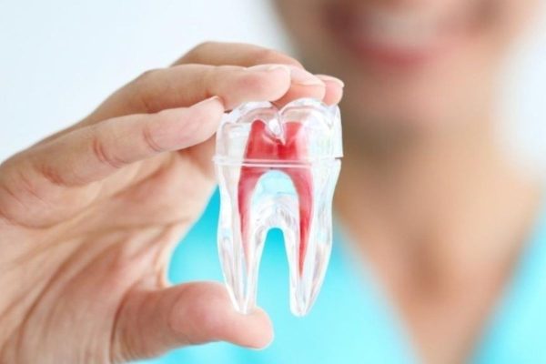 Điều trị tủy răng để bảo toàn chức năng và thẩm mỹ cho răng