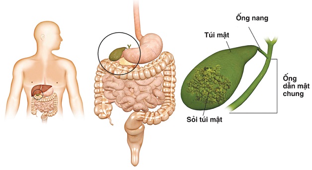 soi mat