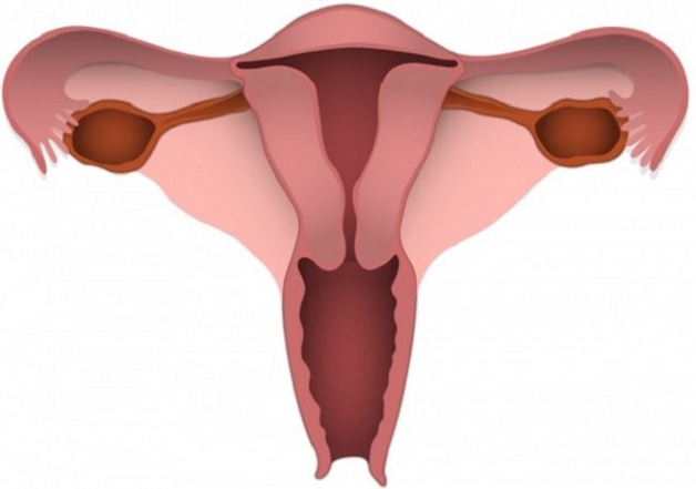 Tác dụng phụ của đặt vòng tránh thai - Rách tử cung