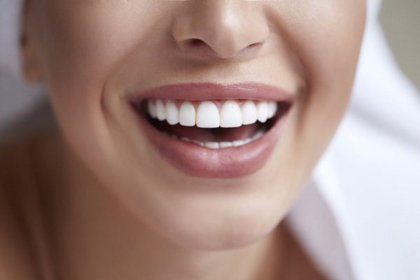 Sở hữu hàm răng đều đẹp, chắc khỏe chính là lời giải cho câu hỏi tại sao nên bọc răng sứ phục hình