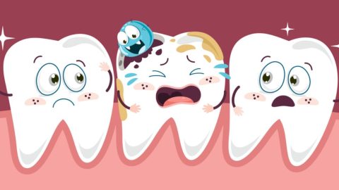 Tìm hiểu 3 mức độ sâu răng và cách điều trị