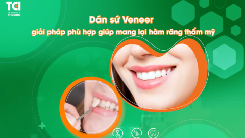 Dán sứ Veneer – Giải pháp vàng cho hàm răng khiếm khuyết nhẹ