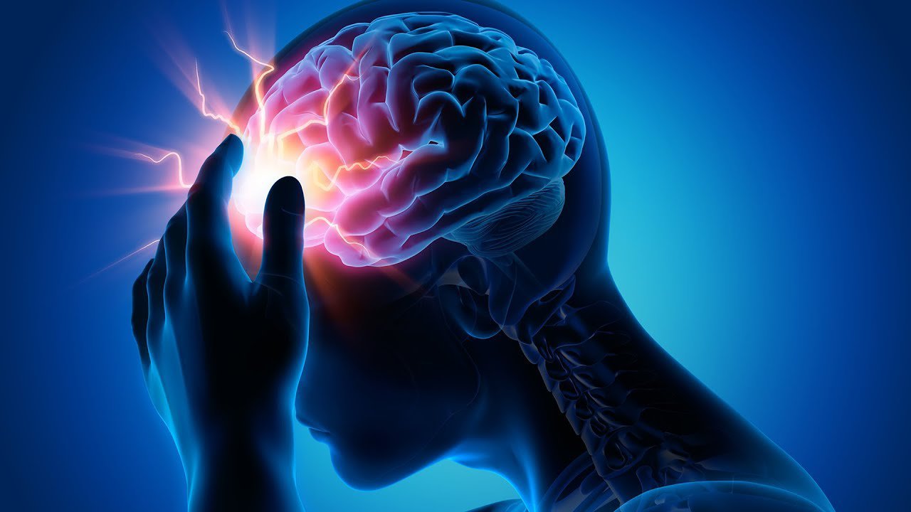 Những biến chứng nặng nề do nhồi máu não gây ra là gì?
