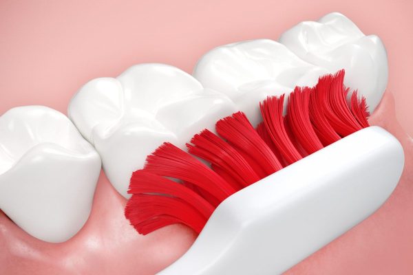 Vệ sinh răng miệng đúng cách để răng không bị sâu, viêm nhiễm