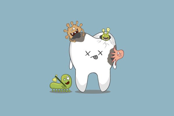 Mảng bám, cao răng không được làm sạch đúng cách trở thành môi trường lý tưởng để vi khuẩn trú ngụ và gây sâu răng