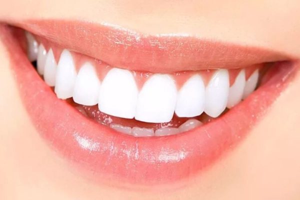 Tẩy trắng răng là phương pháp tạo ra phản ứng làm đứt chuỗi phân tử màu trong ngà răng