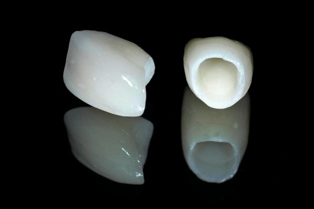 Khác hoàn toàn 3 loại phía trên, răng toàn sứ chỉ có sứ nguyên khối, không kim loại.