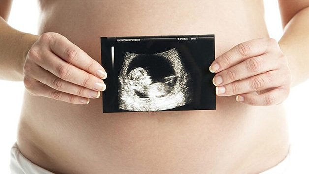 Dây rốn quấn cổ thai nhi là tình trạng thường gặp ở thời điểm gần chuyển dạ hay trong quá trình sinh