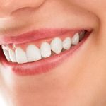 Tìm hiểu về phương pháp phẫu thuật đường cười hở lợi