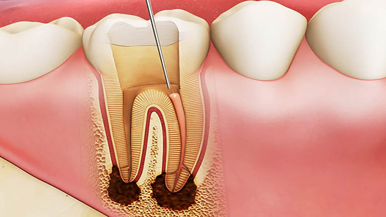 Làm thế nào để duy trì sức khoẻ răng miệng và ngăn ngừa sâu răng?