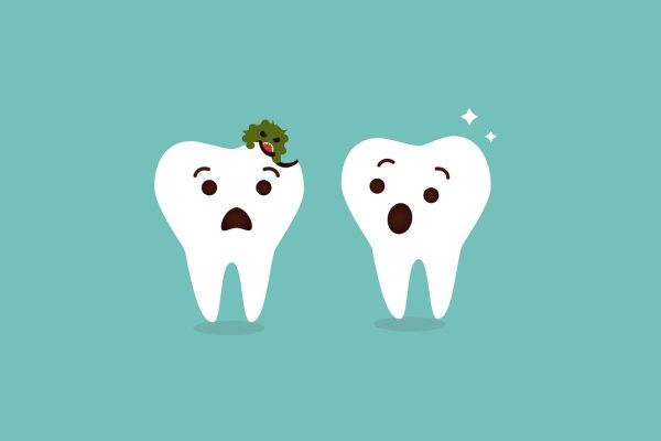 Sâu răng là tình trạng tổ chức răng bị tổn thương bởi vi khuẩn, vi sinh vật có hại.