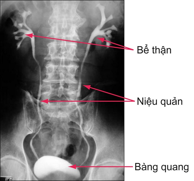 soi nieu dao nu 3