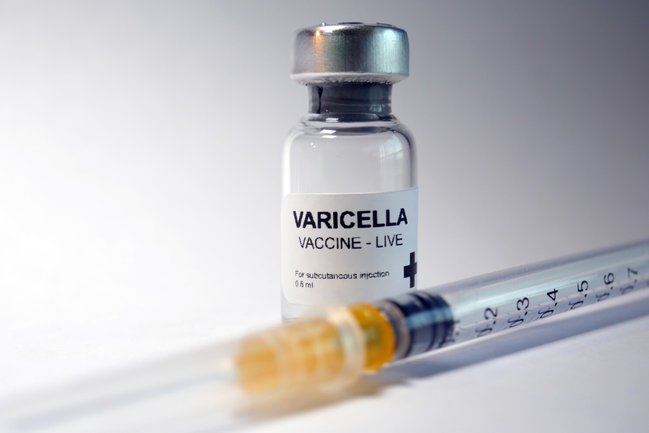 Cách sử dụng vắc xin phòng thủy đậu Varicella của Hàn Quốc.
