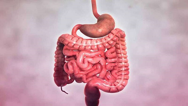 hội chứng crohn gây ra bởi nguyên nhân nào