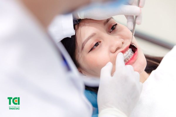 Niềng răng là giai đoạn rất nhạy cảm đối với răng miệng, dễ bị các tác nhân có hại tấn công nên cần được chăm sóc đúng cách