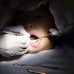 Hàn răng sâu giúp chặn đứng cơn đau sâu răng cho bé 5 tuổi