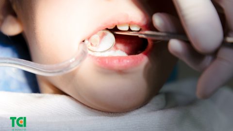 Quá trình trám 9 răng sâu cho bé gái 9 tuổi? Trám răng sâu có đau không?