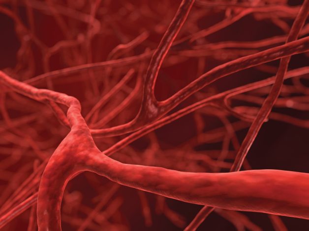 Bệnh xuất huyết dịch kính có thể là do mạch máu bất thường tăng sinh