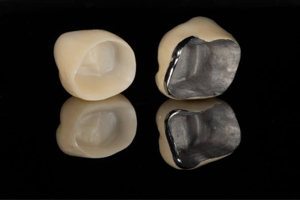 Răng sứ bán phần được chế tác từ hai chất liệu đặc biệt là hợp chất sứ cao cấp ở mặt ngoài và kim loại ở mặt trong của mão sứ