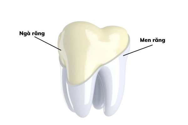 Hình thể răng với phần men răng ở phía ngoài cùng và ngà răng ở sau men răng
