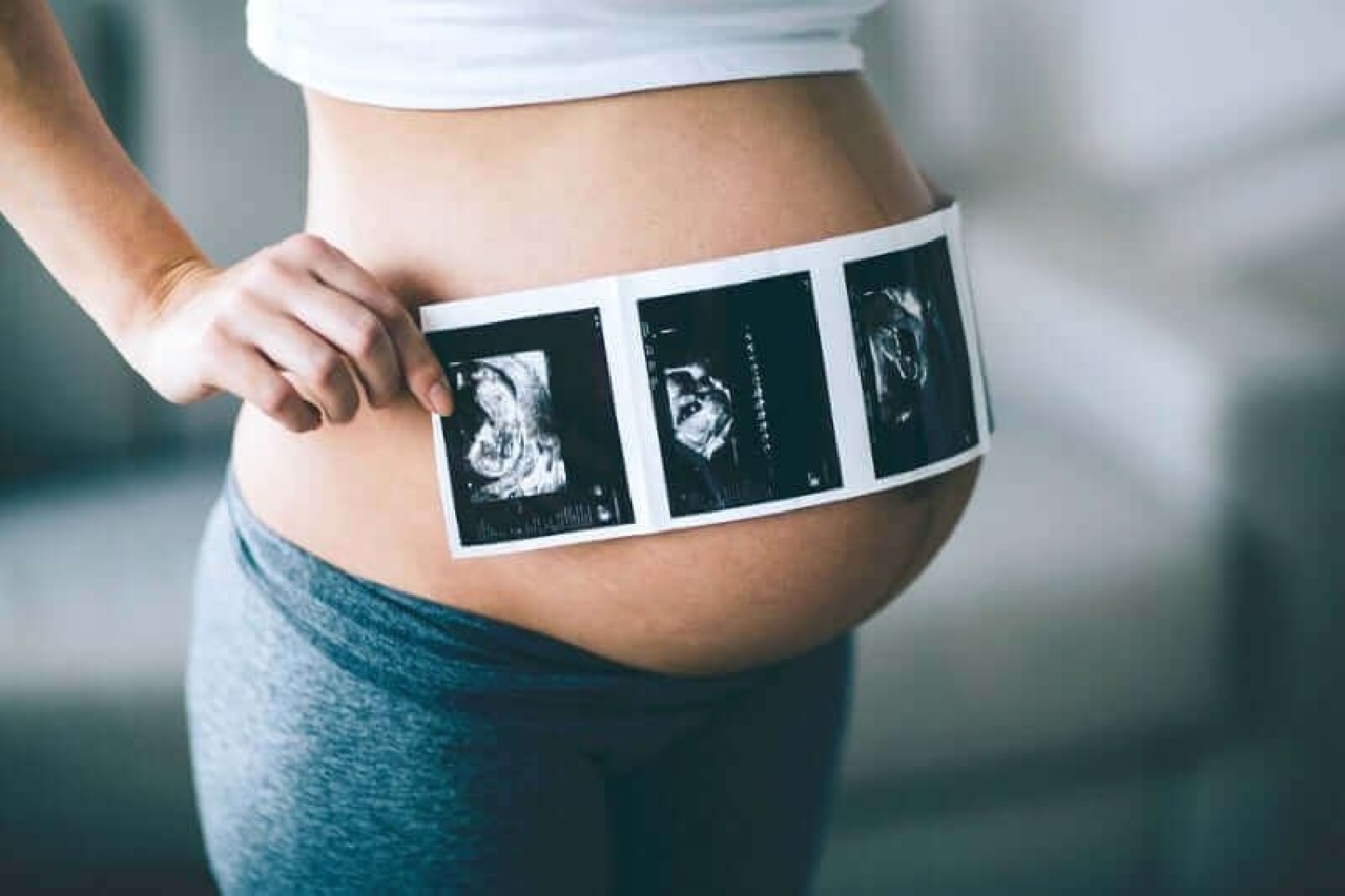 Cách lựa chọn nên siêu âm thai ở tuần 31 hay 32 để đảm bảo an toàn