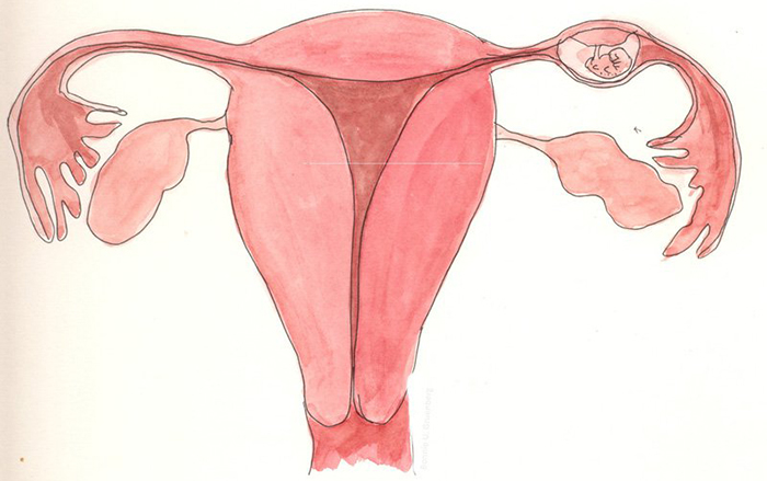 Hiện tượng thai ngoài tử cung không hiếm gặp ở phụ nữ trong độ tuổi sinh nở